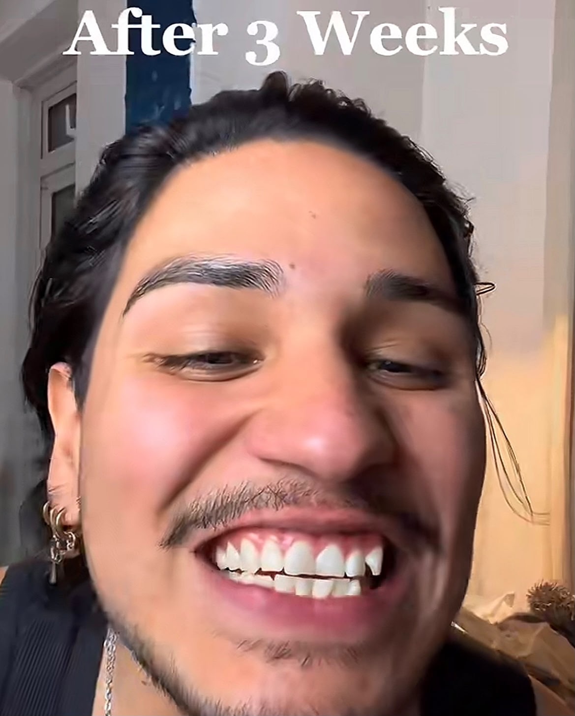 ASCEND 3D CHARCOAL WHITENING STRIPS™